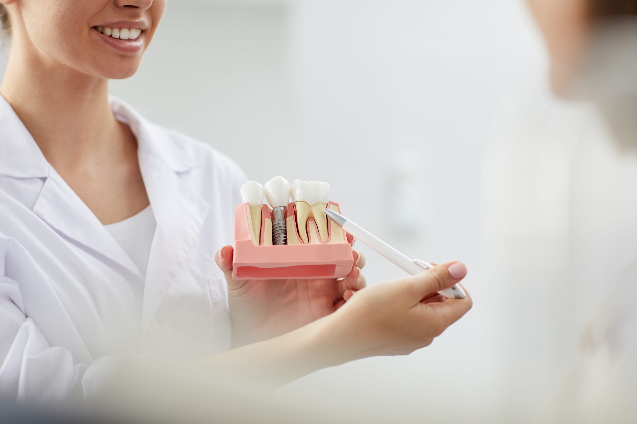 dental implants marietta
