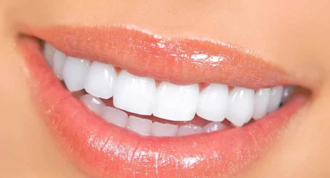full arch teeth in a day in marietta ga