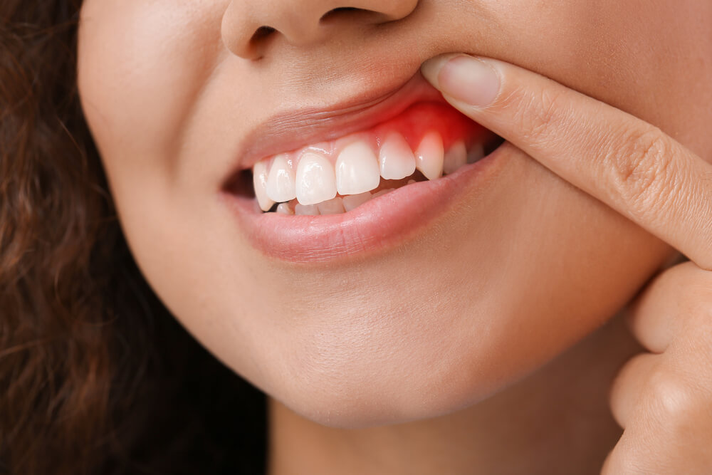 diagnosis treatment of periodontal disease