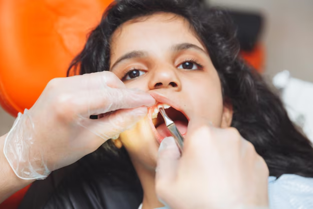 Looking for a safe and effective frenectomy in Marietta? Discover how this simple procedure can improve speech, eating, and oral health. Learn more and find a frenectomy near me today!