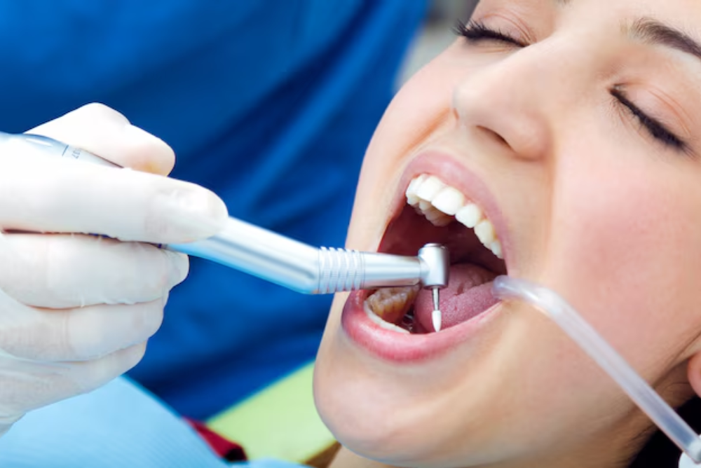 Looking for scaling and root planing near you? Kennestone Periodontics in Marietta offers gentle deep cleaning to protect your gums and restore oral health