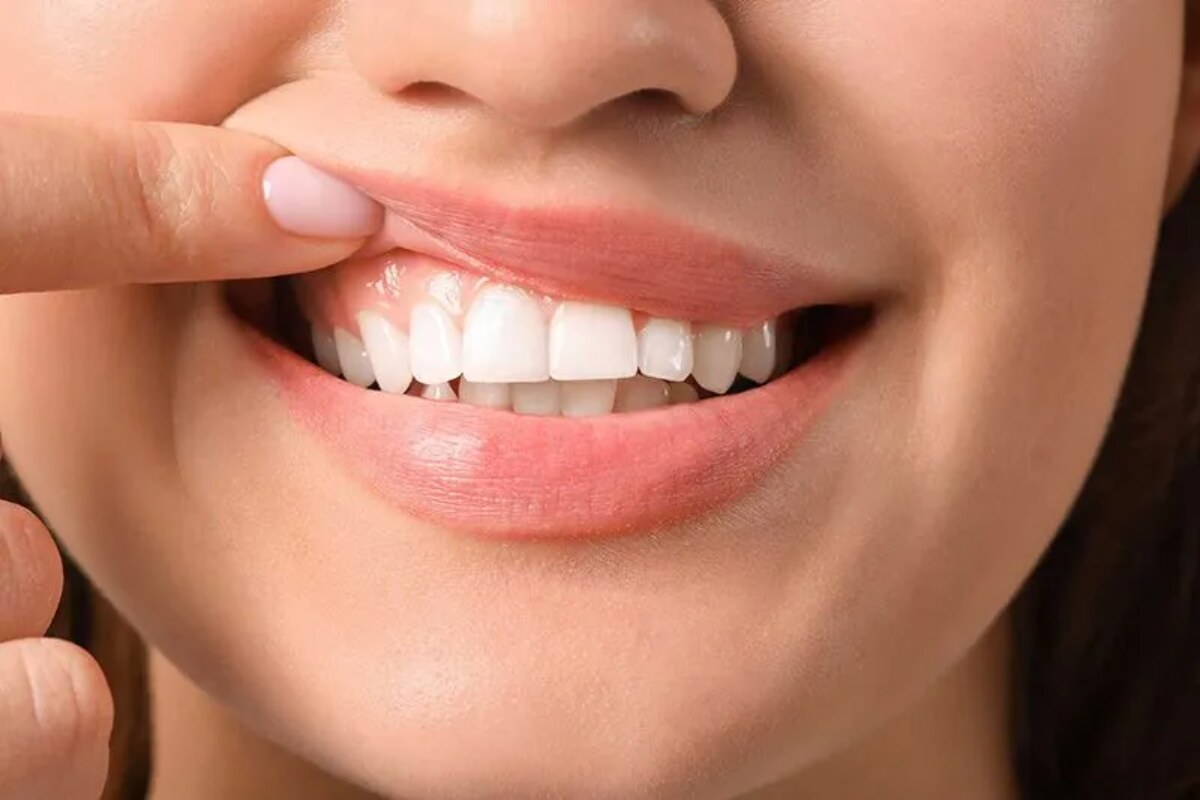 can gum grafts save your teeth